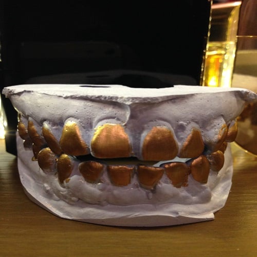 Dental Gold Teeth